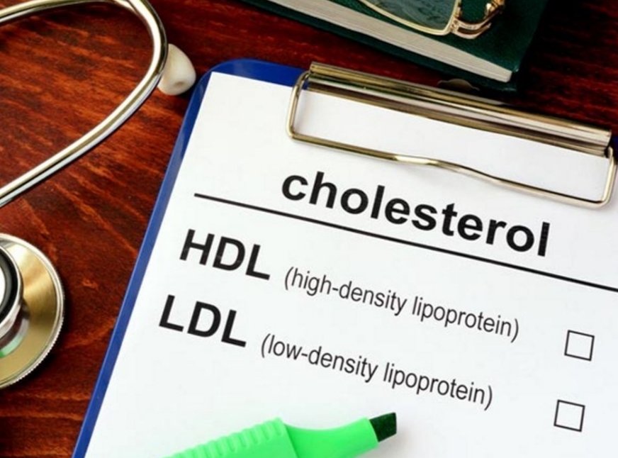 1 dari 3 Orang Indonesia Punya Kolesterol Tinggi, Kenali Risikonya untuk Jantung