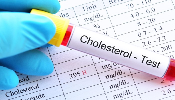 Simak, Kadar Kolesterol Normal Bedasarkan Usia