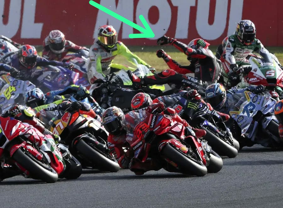 Operasi Sukses! Jorge Martin Terancam Absen Panjang Setelah Insiden di Motegi