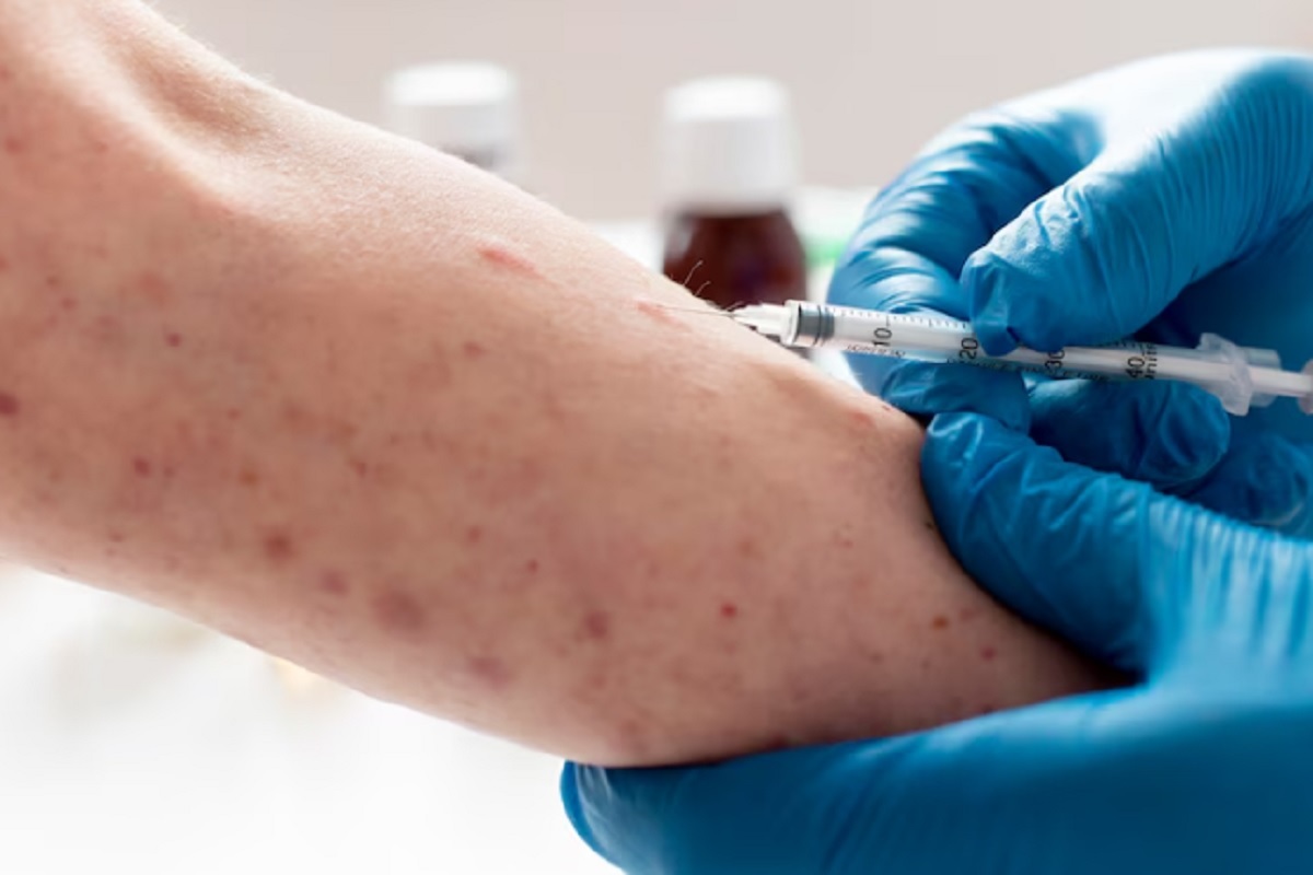 Virus Monkeypox Jadi Ancaman Dunia, WHO Sebut Cacar Monyet Berstatus 'Darurat Kesehatan Global'