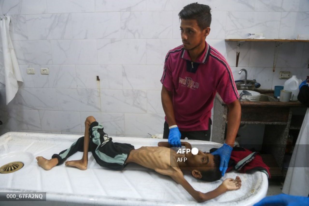 Krisis Kemanusiaan di Gaza: 21 Anak Meninggal Karena Kelaparan, Bantuan Terbatas