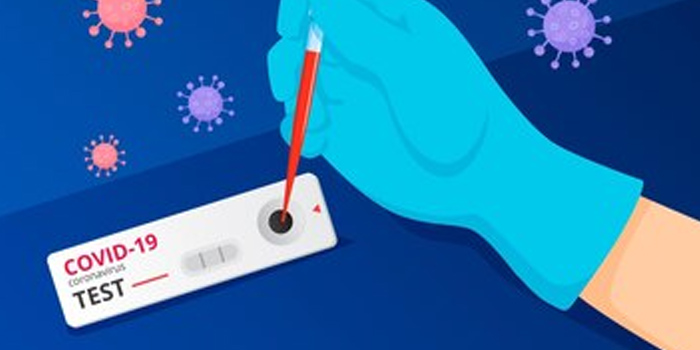 Kejanggalan Pengadaan Alat Tes Antigen Ditemukan BPK