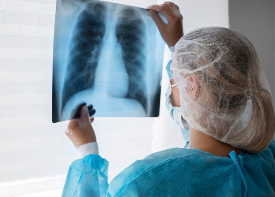 Peringatan Hari Tuberkulosis pada 24 Maret, Kasus TB di Indonesia Tertinggi Kedua di Dunia 