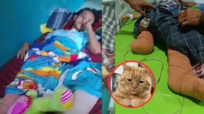 Heroik, Nabila Febriati Kehilangan Kaki Demi Selamatkan Kucing