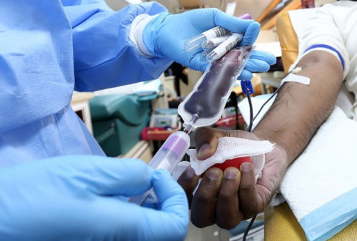Ini 4 Manfaat Transfusi Darah yang Wajib Diketahui, Ketahui Berbagai Risikonya