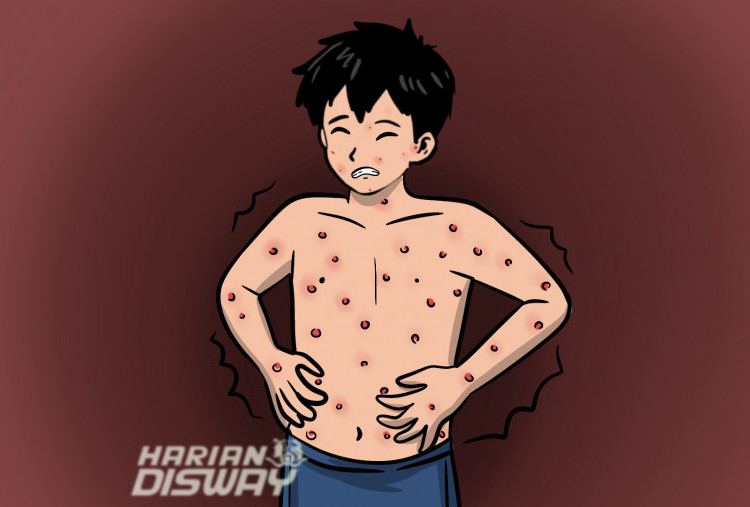 Keperkasaan Penyakit Campak