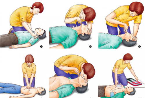 Pentingnya Menguasai Teknik CPR, Pertolongan Pertama Pada Korban Insiden Itaewon