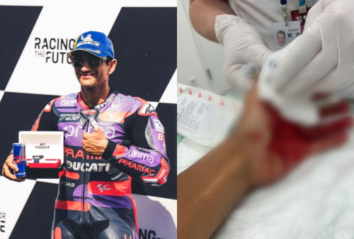 Jempol Tangan Kiri Jorge Martin Cedera, Kesulitan Tarik Kopling Untuk Balap di MotoGP Austria 2024