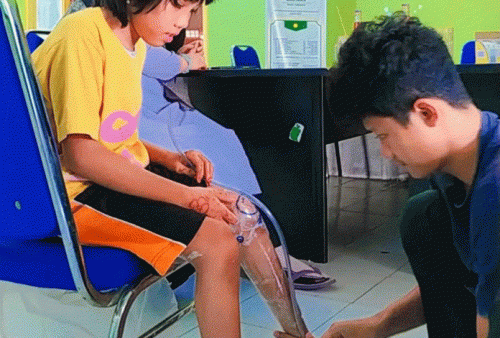 Baznas Kota Cirebon Bantu Kaki Palsu Disabilitas