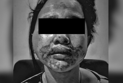 Brutal! Budyanto Tindih Tiara yang Tengah Hamil 4 Bulan saat Kabur Minta Pertolongan, Sang Ibunda Ikut Terkena Pukulan