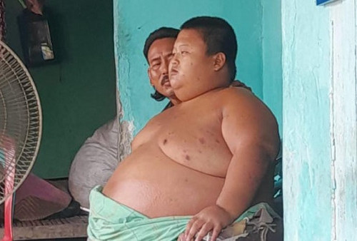 Sebelum Meninggal, Bocah Obesitas asal Bekasi Mengeluh Sesak Nafas