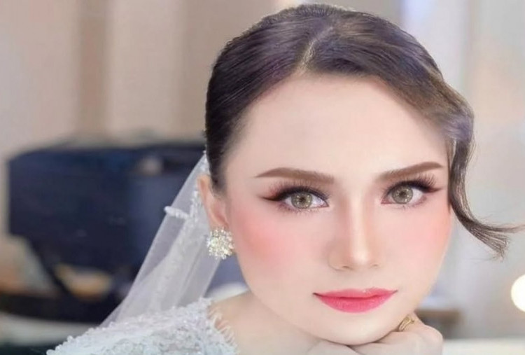 VIRAL Model Profesional Ansy Jan De Vries Diduga Jadi Korban Begal di Kebon Jeruk, Kondisi Kritis?