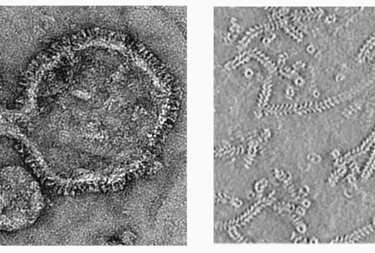 Tanggapi Wabah hMPV, Pakar Sarankan Cukup Lakukan 5M dan Gunakan Vaksin Flu