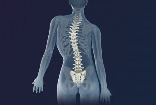 Skoliosis Bisa Disembuhkan Tanpa Operasi di Spine Clinic Family Holistic