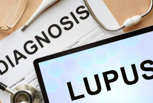 Ahli UI Ungkap Gejala dan Fakta Penting Lupus, Dikenal dengan Penyakit Seribu Wajah