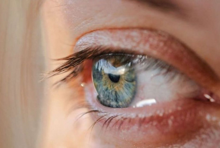 4 Penyebab Penglihatan Kabur saat Puasa dan Langkah Pencegahannya