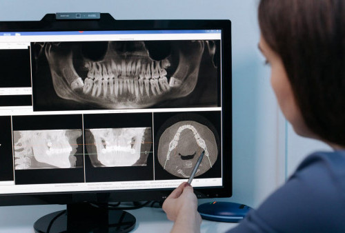Kecerdasan Buatan Bidang Radiologi Kedokteran Gigi (1): Teknologi dan Digitalisasi Dunia Medis