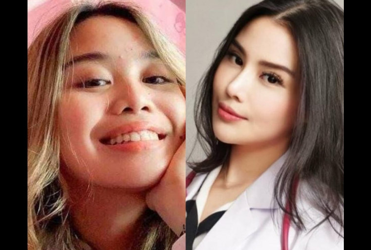 Wajah Cindy Rizap Before and After Oplas Beredar, Dokter Koas yang Dituding Jadi Selingkuhan Suami Maissy 