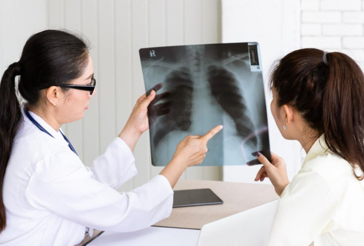 Ini Efek Samping Obat Tuberkulosis, Kenali Gejala sejak dini agar Hati Aman!