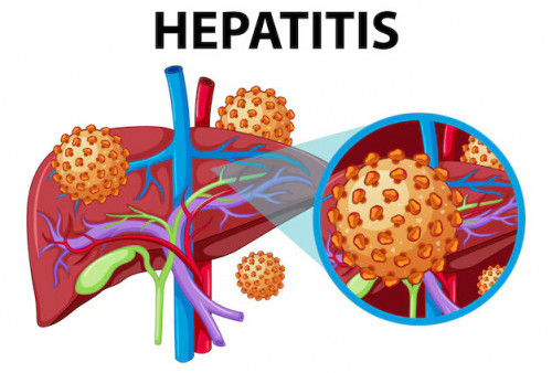 Menuju Hari Hepatitis Sedunia, Kemenkes Ajak Masyarakat Dukung Upaya Eliminasi Hepatitis Tahun 2030