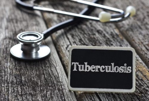 Terpapar Kuman Mycobacterium Tuberculosis Berisiko Sakit TBC, Wajib Ikut Terapi