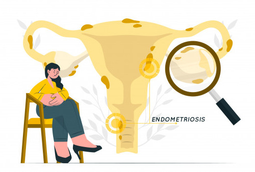 Seputar Endometriosis dan Masalah Kesehatan yang Menyertainya