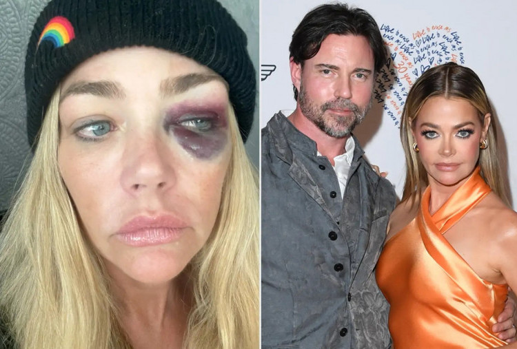 Denise Richards Tuding Aaron Phypers Lakukan Kekerasan Dalam Rumah Tangga