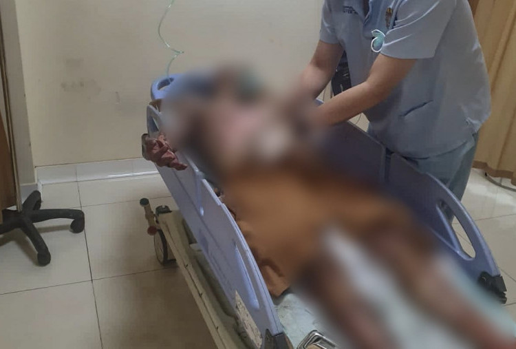 Pelaku Curanmor Yang Terbakar di Jojoran Dirawat di RS Bhayangkara, Motor Korban Dikembalikan Besok