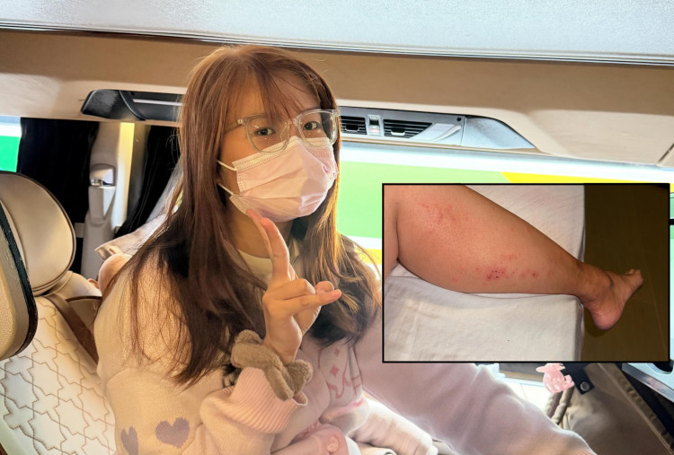 Curhatan Penumpang Bus Sleeper Sinar Jaya Sakit Kulit Gatal dan Bentol: Percuma Bayar Rp300 Ribu!