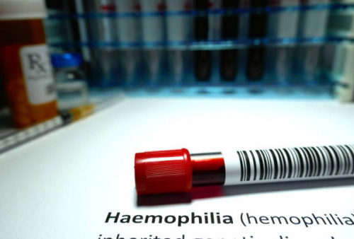 Hari Hemofilia Sedunia Diperingati 17 April, Yuk Kenali Lagi Penyakit Gangguan Darah Ini