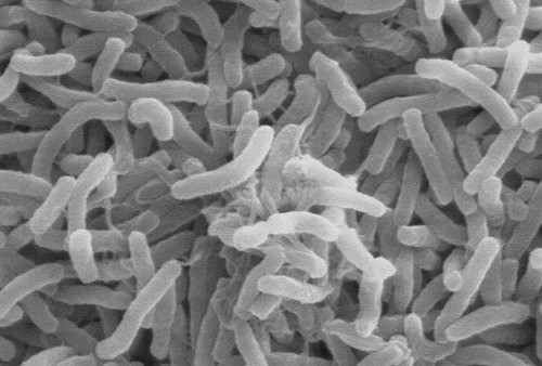 Setelah Covid-91 Warga Wuhan Dihantui Kolera, Bakteri Ditemukan di Kura-kura Cangkang Lunak di Pasar Makanan