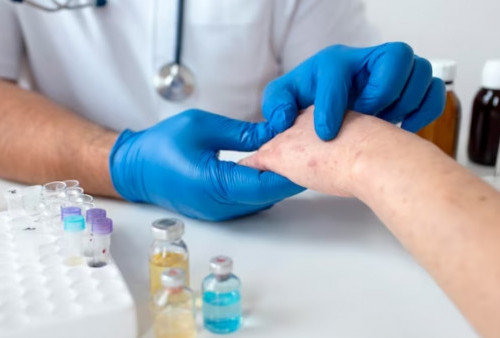 Pemerintah Siapkan Vaksinasi dan Langkah Lain Untuk Mencegah Penyebaran Virus Monkeypox