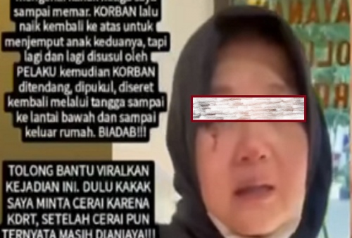 Viral Wanita Mengaku Dianiaya Mantan Suami di Depan Anak-anaknya, Ahmad Sahroni: Galak Amat Sampe Digebukin!