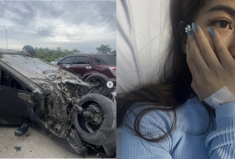 Model Diva Siregar Selamat dari Kecelakaan Maut di Tol, Dokter Sampai Terkejut!