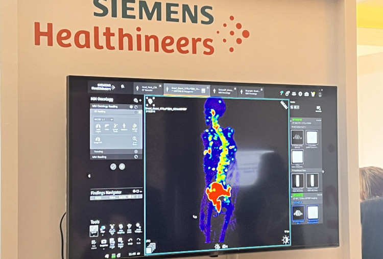 Siemens dan Siloam Perkuat Teknologi Baru, Deteksi Kanker Makin Akurat
