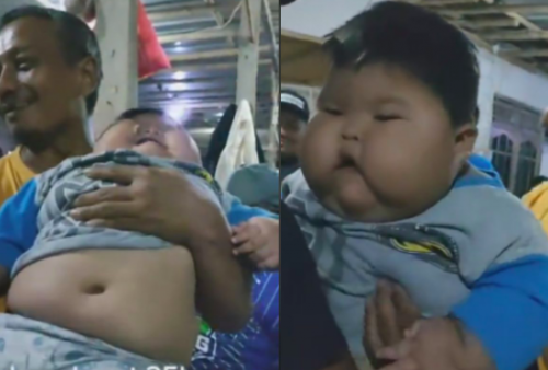 Setelah Viral Bayi 1 Tahun Berbobot 27 Kilogram, Ini Provinsi dengan Kasus Obesitas Anak Tertinggi