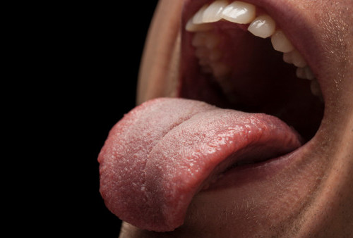 5 Manfaat Bersihkan Lidah Secara Rutin,  Bisa Efektif Hilangkan Bau Mulut?
