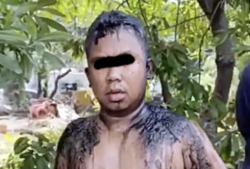 Viral! Seorang Pria Disiram Air Keras Oleh OTK di Di Tanjung Priok, Pelaku Diduga 2 Orang