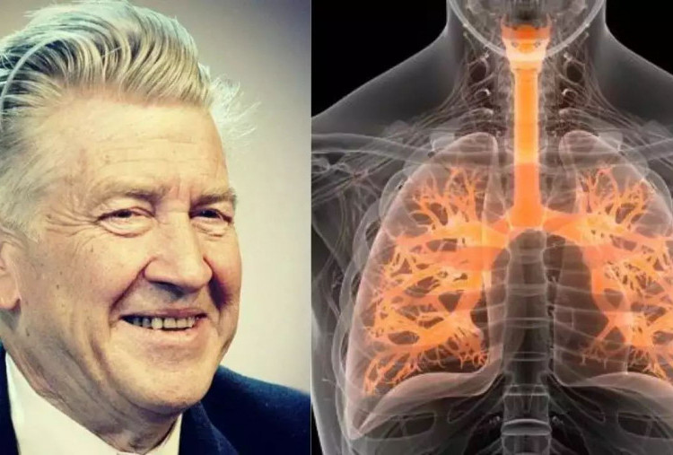 David Lynch Meninggal karena Emphysema, Penyakit Apakah Itu?