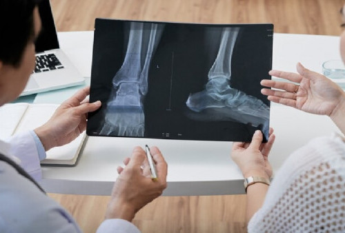 ﻿Ini Daftar Penyakit Tulang dan Sendi yang Bisa Ditangani di Layanan Ortopedi
