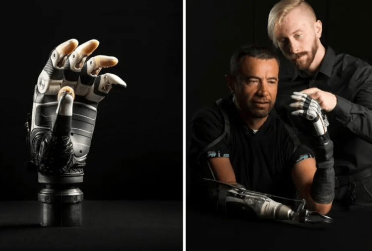University of Utah Ciptakan Tangan Bionik Berbasis AI, Mampu Tingkatkan Kealamian Gerak