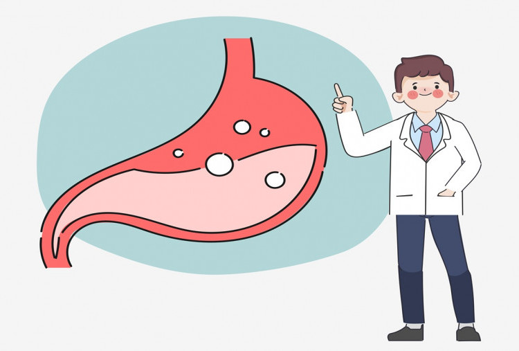 Puasa Aman atau Berbahaya bagi Penderita GERD? Ini Penjelasan Dokter