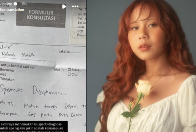 Apa Itu Disfonia Spasmodik yang Dialami Nadin Amizah? Pecinta Musik Wajib Tahu