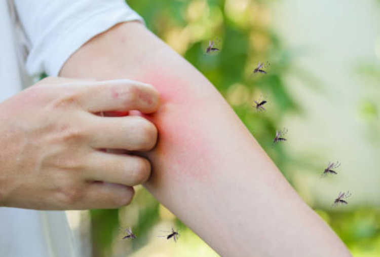 5 Tips Cegah Gigitan Nyamuk yang Efektif dan Mudah