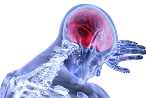 Penelitian: 'Kabut Otak' Akibat Covid Sama Buruknya dengan Penuaan 10 Tahun!