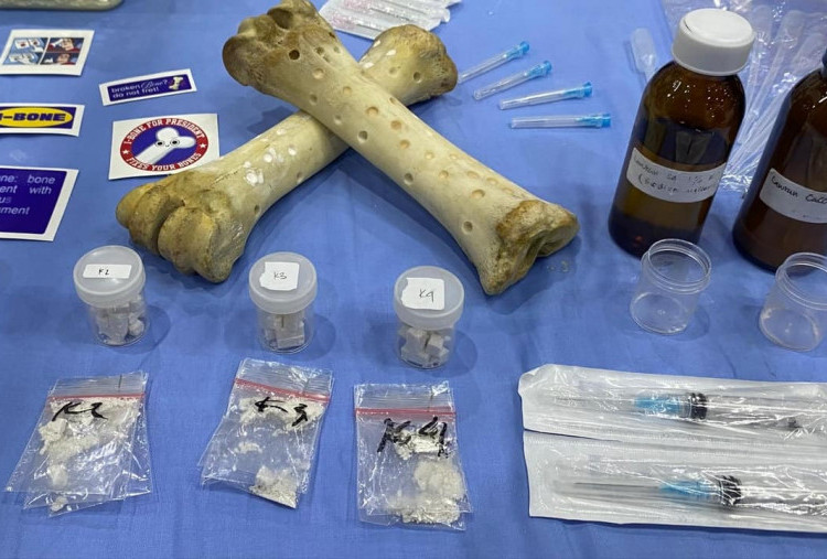 Mahasiswa Unair Ciptakan Semen Tulang Injeksi, Pendukung Regenerasi Tulang untuk Osteoporosis