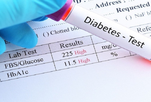 Angka Diabetes Tinggi, Penting Cek Gula Darah dan HbA1c