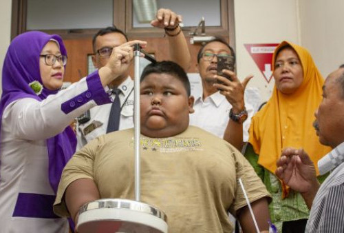 Indonesia SDM Hebat: Atasi Obesitas untuk Membangun SDM yang Berkualitas