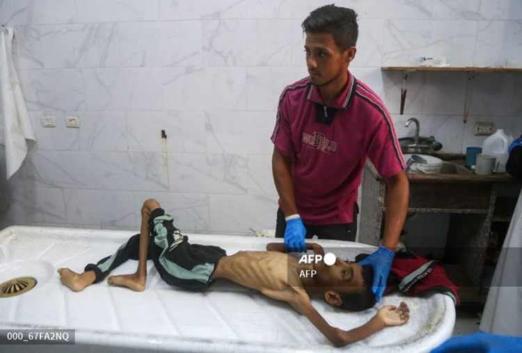 Krisis Kemanusiaan di Gaza: 21 Anak Meninggal Karena Kelaparan, Bantuan Terbatas