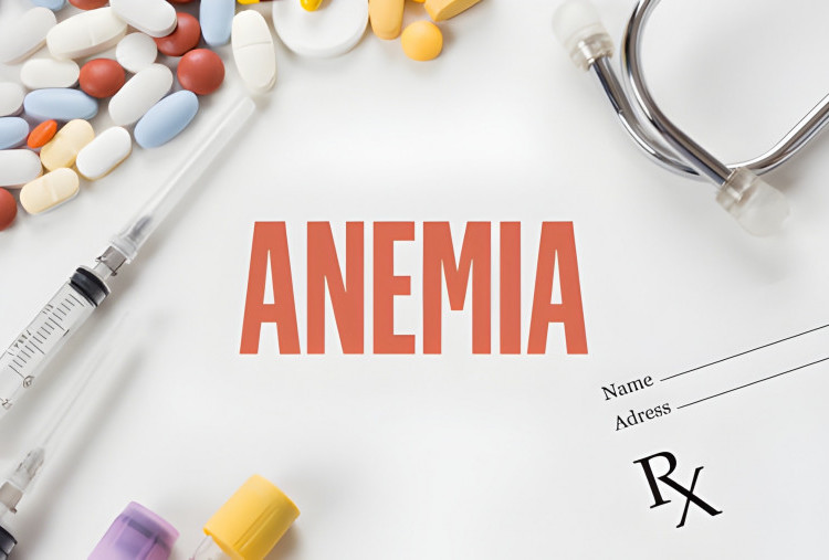 Anemia Defisiensi Zat Besi: Gejala, Dampak, dan Cara Mencegahnya